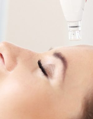 PRP YCELL HA +DERMAPEN