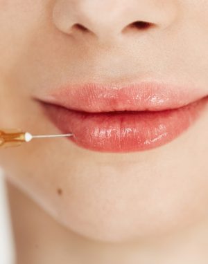 فيلر بكيني 4مل+ تقشير البكيني مجاناُ